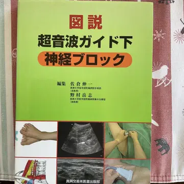 도설 초음파 가이드 하 신경 블록