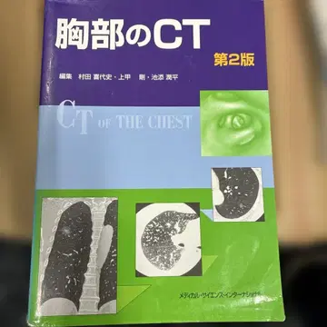 흉부 CT