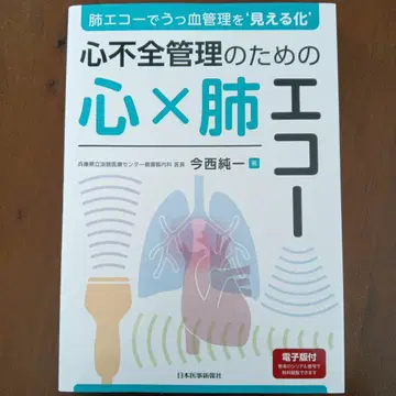 심부전 관리를 위한 심폐 에코