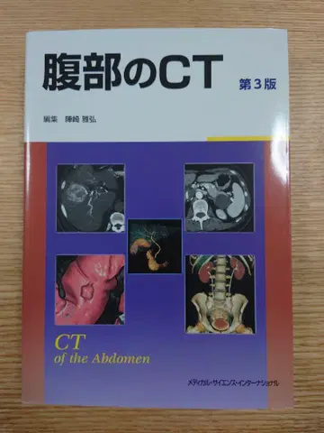 복부 CT 제3판