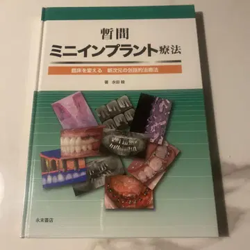 잠정 미니 임플란트 요법