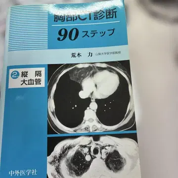 흉부 CT 진단 90단계 2