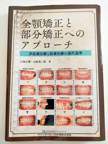 [재단 완료] 전악 교정과 부분 교정에 대한 접근
