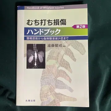 목 염좌 핸드북: 경추 염좌부터 뇌척수액 감소증까지