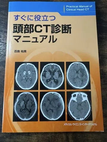 바로 활용 가능한 두부 CT 진단 매뉴얼