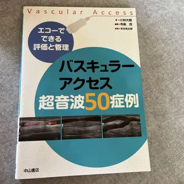 혈관 접근 초음파 50례 에코로 가능한 평가와 관리