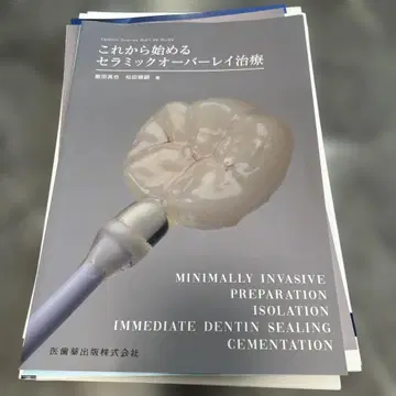 이제 시작하는 세라믹 온레이 치료 재단 완료