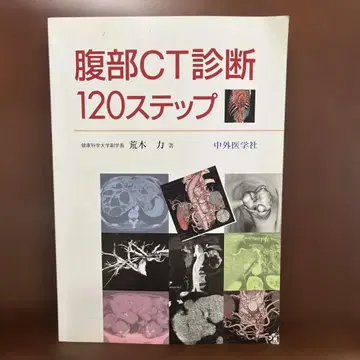 복부 CT 진단 120단계