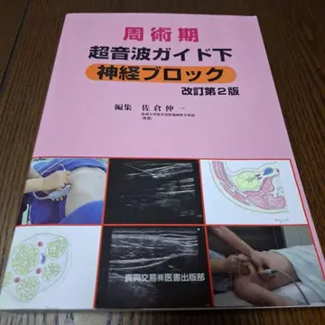 수술 전후 초음파 가이드 신경 블록