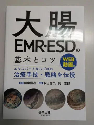 대장 EMR ESD의 기본과 요령