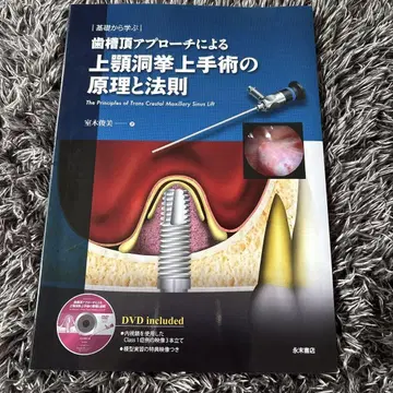 상악동 확장술의 원리와 법칙
