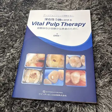 Vital Pulp Therapy 심부 우식에 대한 치료법