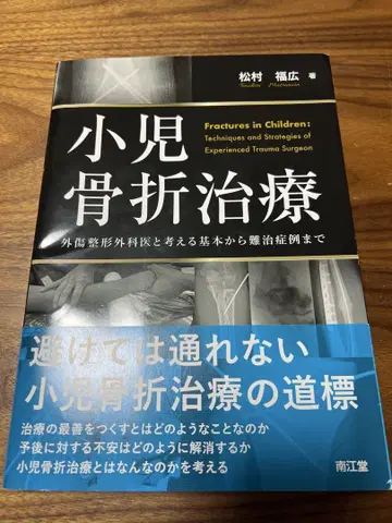 재단 완료 소아 골절 치료