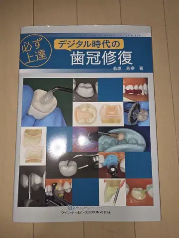 반드시 실력 향상 디지털 시대의 치관 복원 (재단 완료)