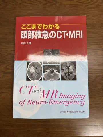 여기까지 이해하는 두부 응급 CT MRI