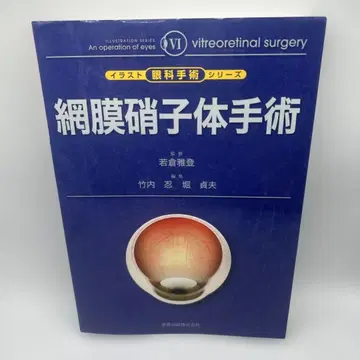 망막 유리체 수술 레어템
