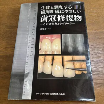 치관 수복물 그 생각과 기법 워크