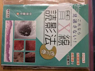 이것이라면 놓치지 않아! 위 X선 판독법