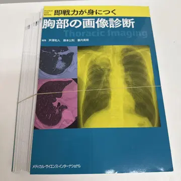 재단 즉시 실전 능력을 키우는 가슴 이미지 진단