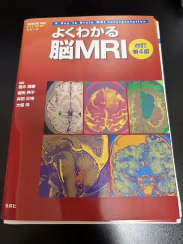 [재단됨] 알기 쉬운 뇌 MRI 개정 제4판