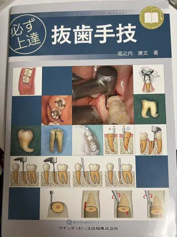 반드시 실력 향상 발치 술기