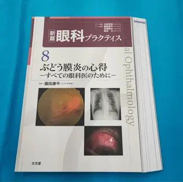 재단 완료 신편 안과 프랙티스 8 포도막염의 수련법