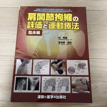어깨 관절 구축 평가 및 운동 요법 임상편
