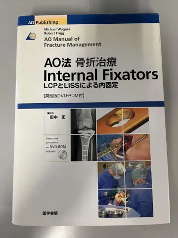 AO법 골절 치료 Internal Fixators