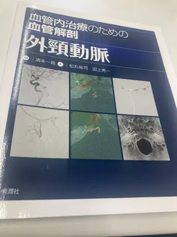 혈관 내 치료를 위한 혈관 해부 외경동맥