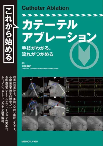 재단필 카테터 어블레이션 시작하기 = CatheterAblation