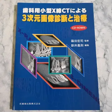 치과용 소형 X선 CT에 의한 3차원 이미지 진단과 치료