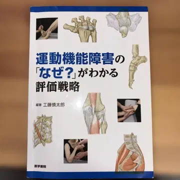 운동 기능 장애의 [왜?]를 알 수 있는 평가 전략