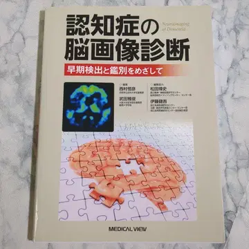 [ 새상품급 ] 치매의 뇌 이미지 진단