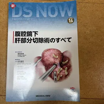 복강경 간 부분 절제술의 모든 것