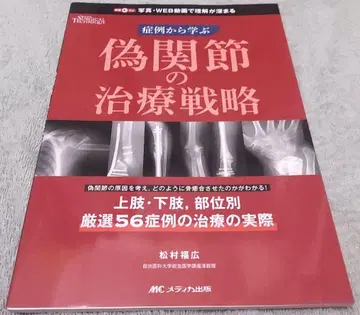 가관절 치료 전략 : 증례로 배우기