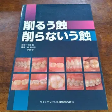 깎는 충치 깎지 않는 충치