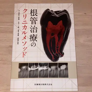 근관 치료의 임상 메소드