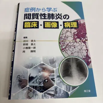 절단된 증례로 배우는 간질성 폐렴의 임상 이미지 병리