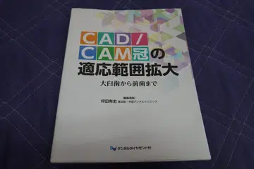 CAD/CAM 크라운의 적용 범위 확대