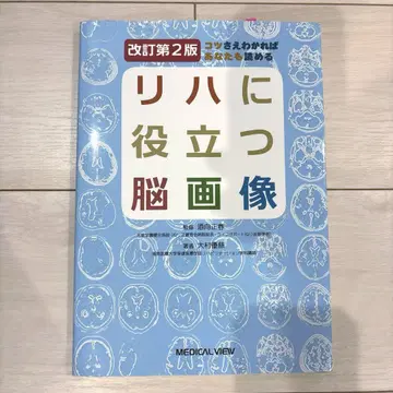 재활에 도움이 되는 뇌 이미지
