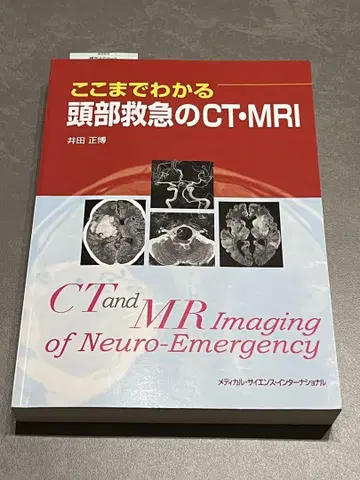 여기까지 이해하는 두부 응급 CT MRI
