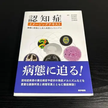 인지증 이미징 텍스트 이미지와 병리에서 본 질환의 메커니즘 t82