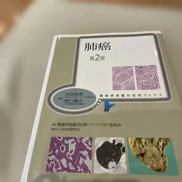폐암