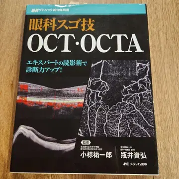 안과 스고기 OCT OCTA 전문가의 판독술로 진단력 업!