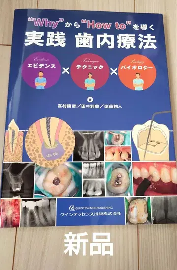 새상품 why에서 'how to'를 이끄는 실천 치근단 치료