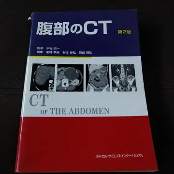 복부 CT