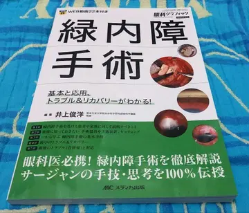 녹내장 수술: 기본과 응용, 트러블 & 리커버리가!