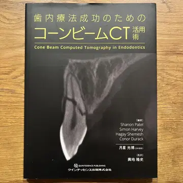 치내 치료 성공을 위한 콘빔 CT 활용술