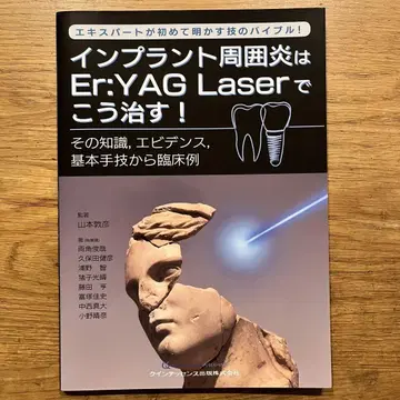 임플란트 주위염은 Er:YAG Laser로 이렇게 치료한다!