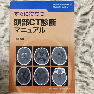 바로 활용 가능한 머리 CT 진단 매뉴얼